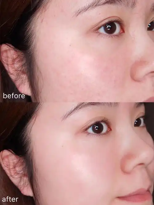 使用前后对比来自网友@小羊羔崽子