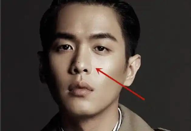 财权相伴的男士痣相,看完不得不信!