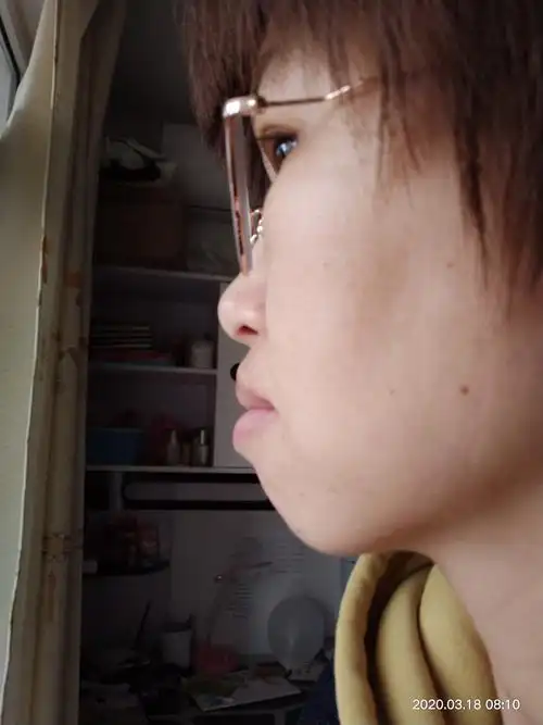 侧脸嘴型很不好看,外凸,还没有下巴的感觉!