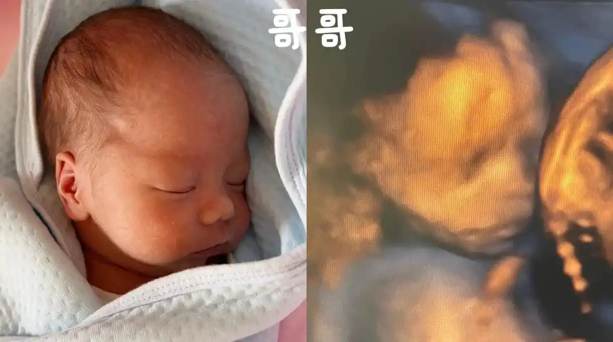 闲来做了四维和出生后的照片对比,后面是同一件衣服从遮住 - 抖音