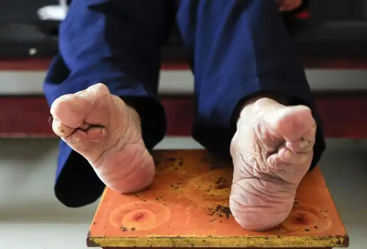 中国最后的小脚女人…三寸金莲,文字,摄影:刘忠仁於2017.2.28摄