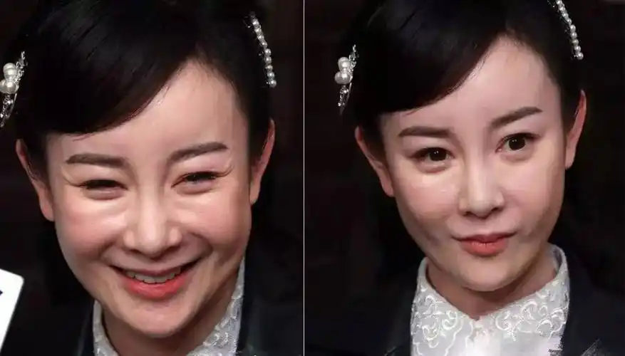 明星整形娱乐圈10位被整容毁掉的女星