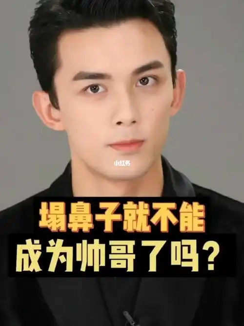 塌鼻子就不能成为帅哥吗