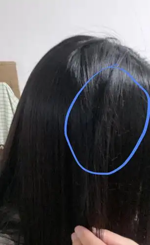 洗完头发有一撮特别毛躁,有姐妹遇到过吗