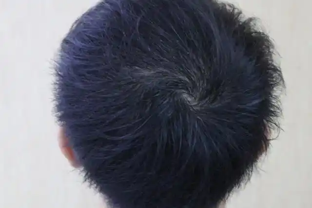 也没有弹性,这类发质属于干发质;中性发质:洗过头24-48小时后,头皮