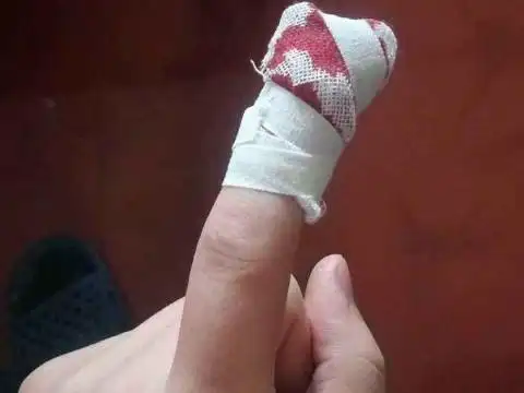 梦见手指被切掉一截