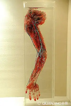 人体手臂血管标本特写