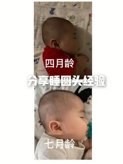 睡头型经验分享7515扁头如何睡成小圆头