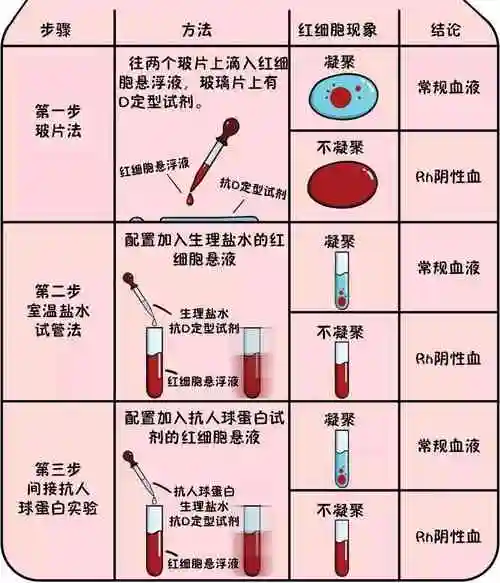 rhd阴性血型检测流程示意图