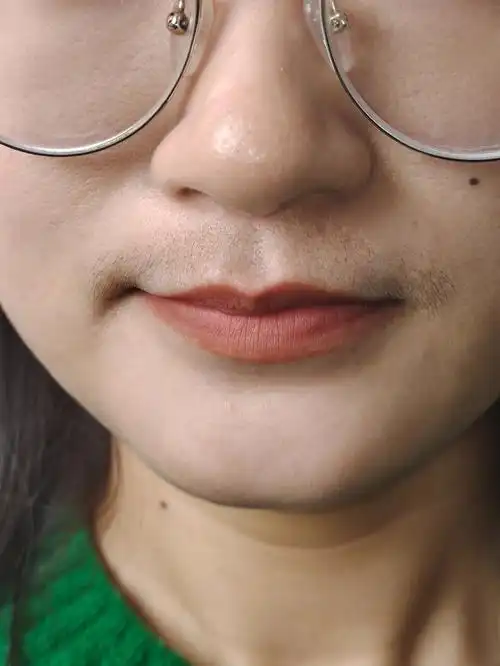 女生小胡子 #女生小胡子怎么处理