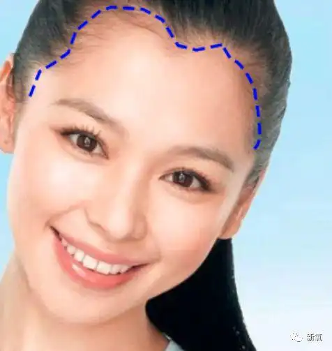 这种发际线在现实生活中其实不                    剧的头套.