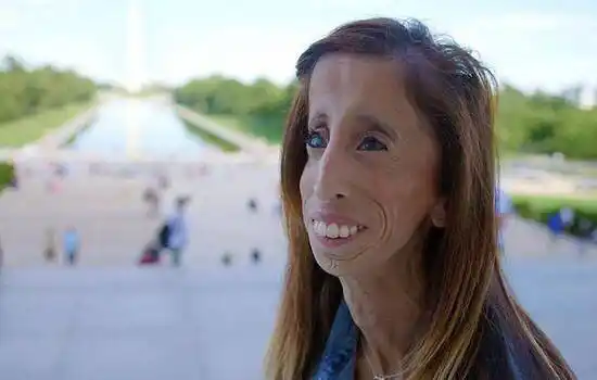 晒一晒,丑头丑脸