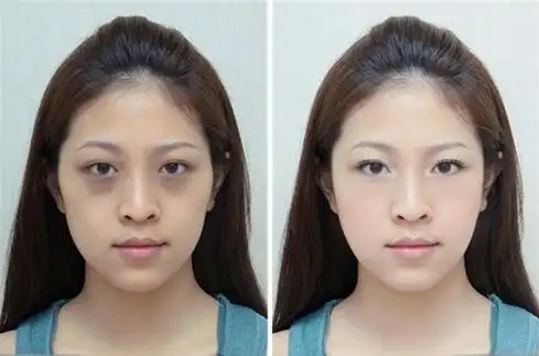 熬夜对皮肤的危害有多大?对比一下就知道