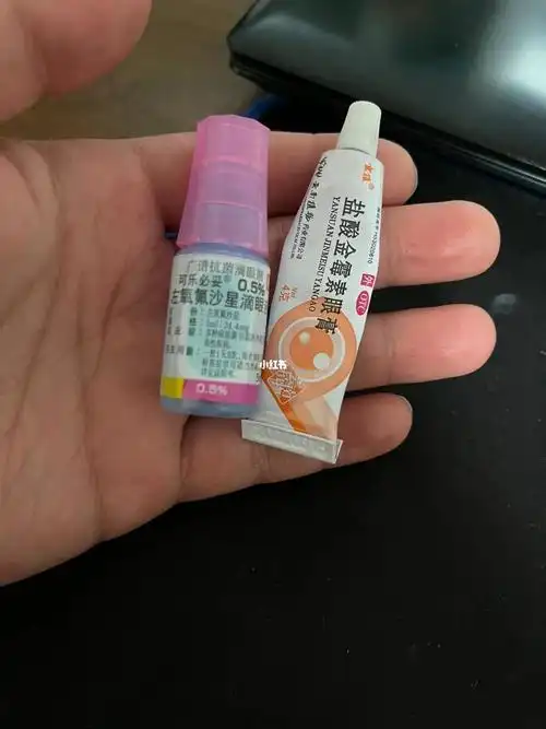感觉越来越严重!后面是刷小红书说用金霉素眼膏!我就买了!