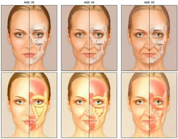 匠欣国际医美技术院长郑喜春浅谈面部年轻化及抗衰老