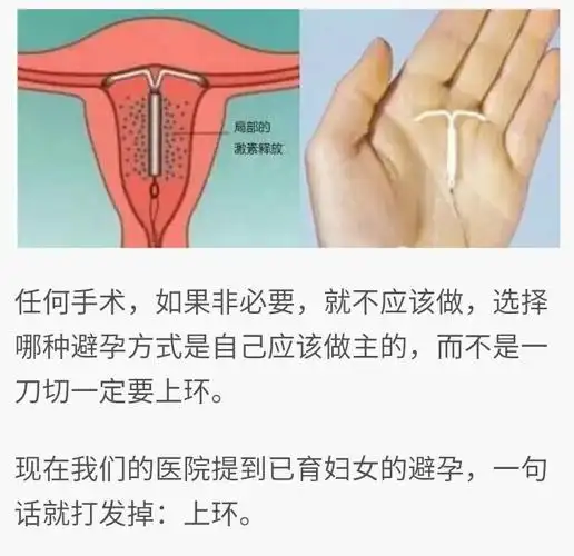 你上环了吗女人一定要看,看完想骂人