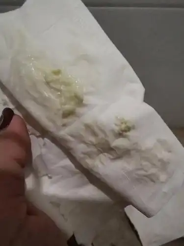 白带没有月经也不来怎么回事