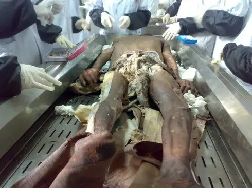 人体断层解剖真人标本图片