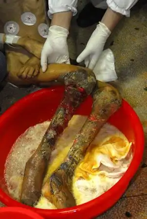 周公解梦之梦见很多腐烂的尸体没有腐臭味