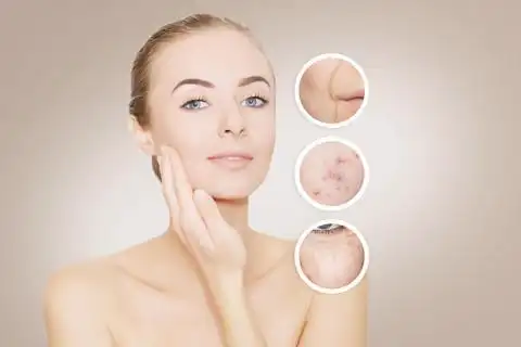 修复皮肤︰ 女人带走她旧的皮肤