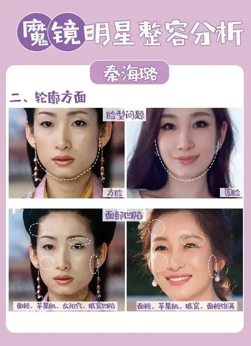 新氧魔镜明星整容前后分析以秦海璐为例