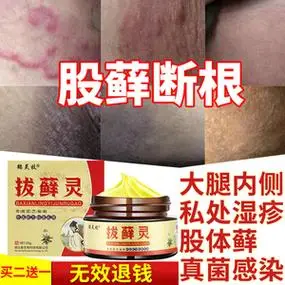 股藓大腿内侧真菌感染私处屁股治疗皮肤体癣湿疹止痒去根股癣药膏