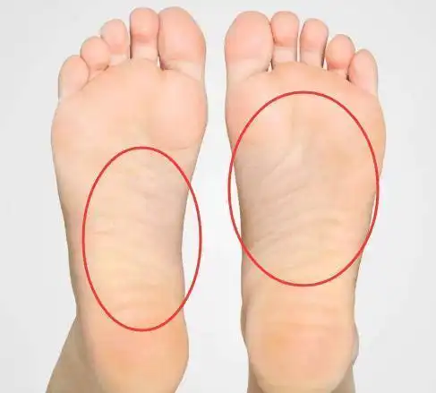 别怪我发晚了: 女人一生命运好不好, 就看长没长这种脚!