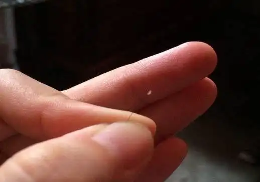 掉发后头发根部小白点你知道是什么吗