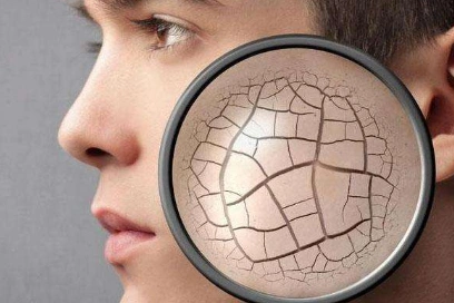 什么鬼超声刀做完皮肤干缺水沙漠大干皮超声刀后怎么补水