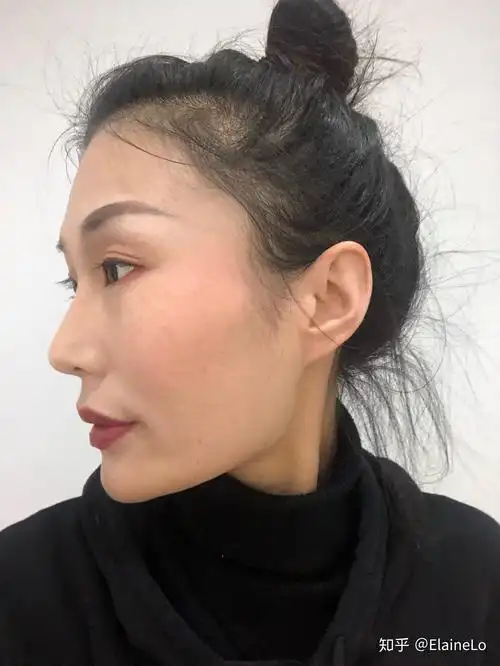 女孩子颧骨低才好看吗?