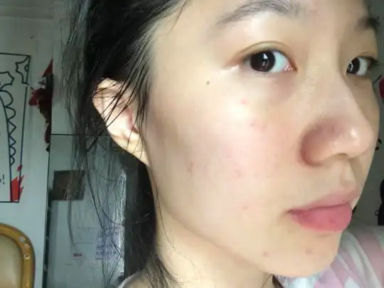 正常人的脸的毛孔图_小红书