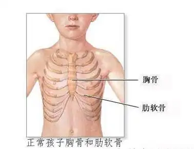 让我欢喜让我忧---先心病术后鸡胸和瘢痕的痛你造吗?