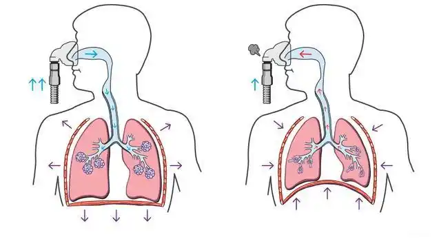 呼吸机治疗慢阻肺原理是什么?