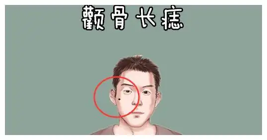 身体5颗巨富痣,只要一个,男人掌权,女人纳福,福泽子子辈辈!