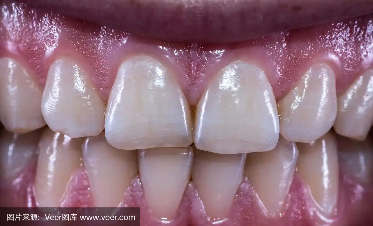 正面观察正常咬合的健康人类牙齿.