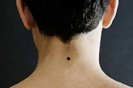 脖子后面的是苦情痣的人命运怎样