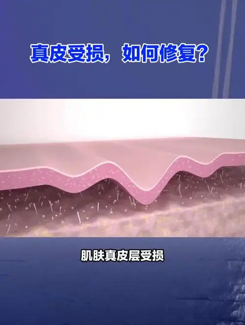 健康养生:肌肤真皮层受损,如何修复?
