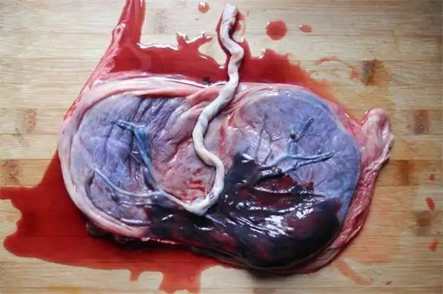 用胎盘做饺子吃可以大补胎盘真的能吃吗