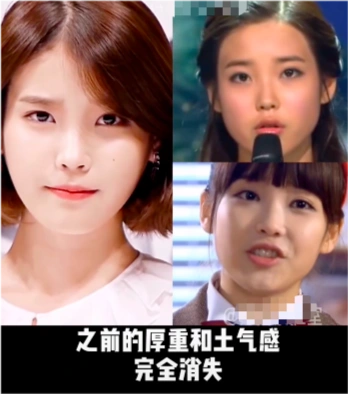 国民妹妹iu疑似整容up主称其整容前很土做完8项手术后美丽又自然