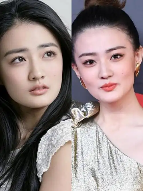 徐璐早期出道时,脸部方的明显,整体骨相都是方的.