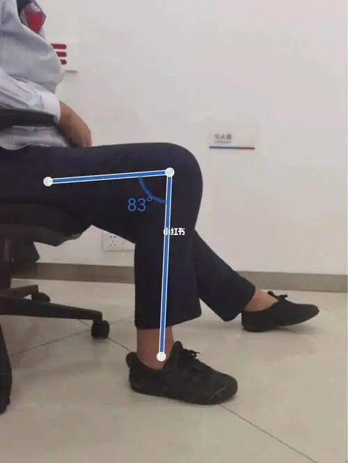 被掰腿了从80度掰到40度