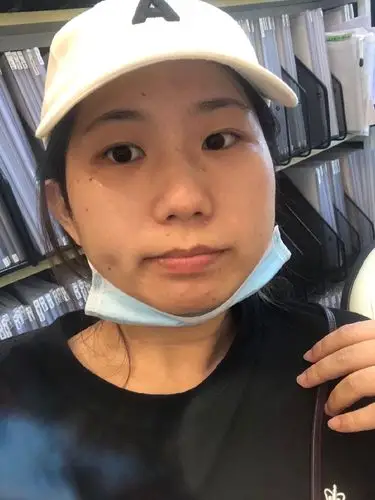 [:163]体验前变美诉求:皮肤真的超级无敌黄,而_圈子-新氧美容整形