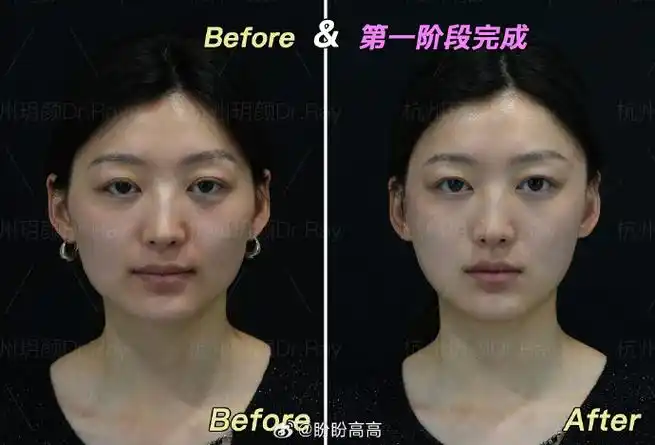 上微博学变美##上微博学变美