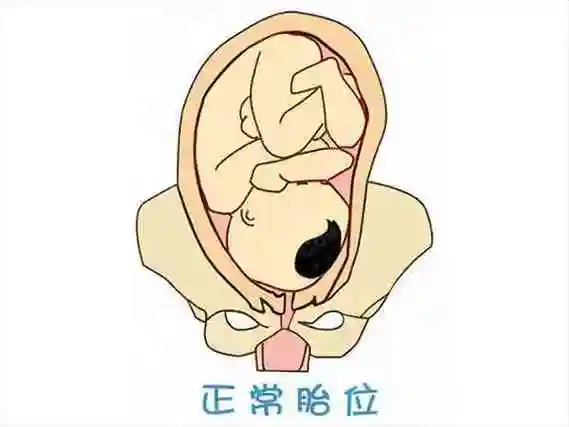 朋友说胎儿头位容易看男女具体怎么看