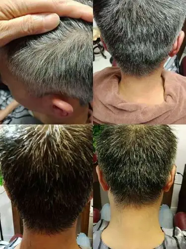 白发,脱发者的福音来啦丝美童颜&咸阳店