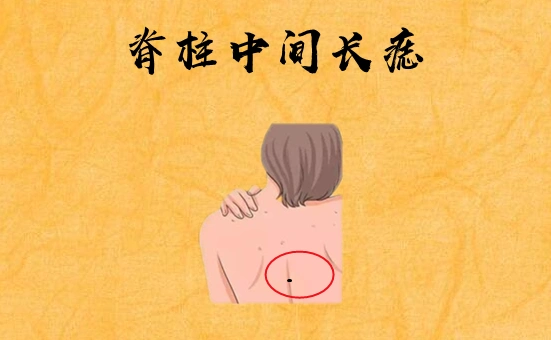 脊柱中间长痣在相学当中,若是在脊柱中间的位置处长有吉痣,则被称之为