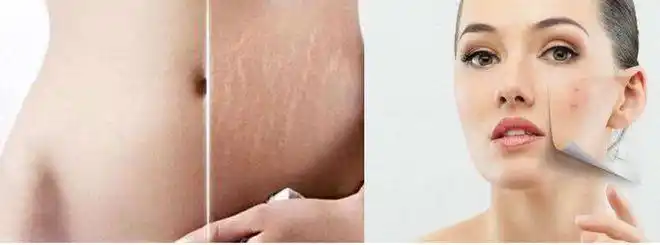 用绵羊油涂抹全身,可以让胳膊,大腿,肚子等松弛的肌肤,恢复肌肤弹力