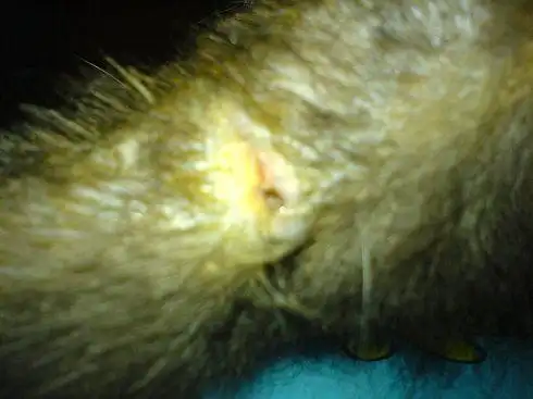 女性外阴毛囊炎图片