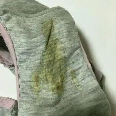 孕8周有这样的分泌物正常吗,cb检查有胎心胎芽胎心孕酮33