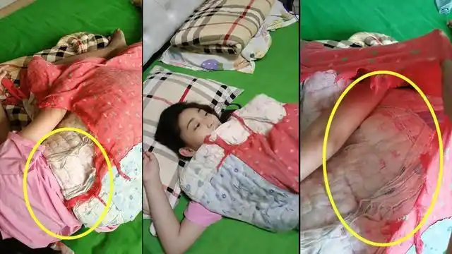 在网上看到一段视频,视频中一名12岁的女孩正在床上躺着,而她身上却